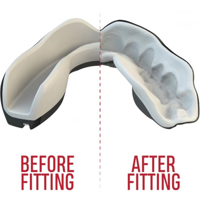 OZ-TT "Extro Fangz" Mouthguards Black In preparation Your Sports Performance